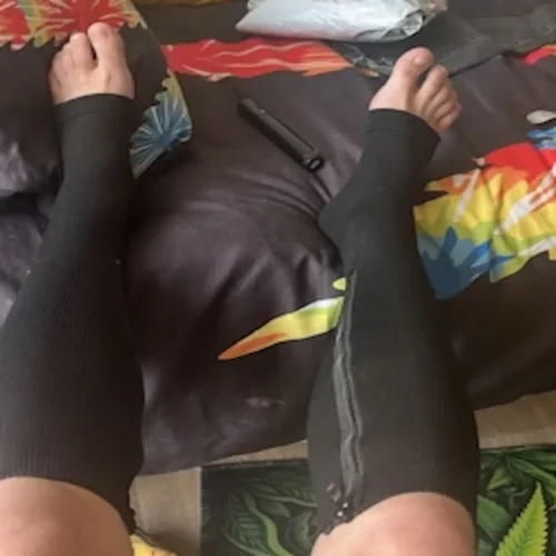 Kompressionsstrümpfe mit Reißverschluss – Größen bis 3XL photo review