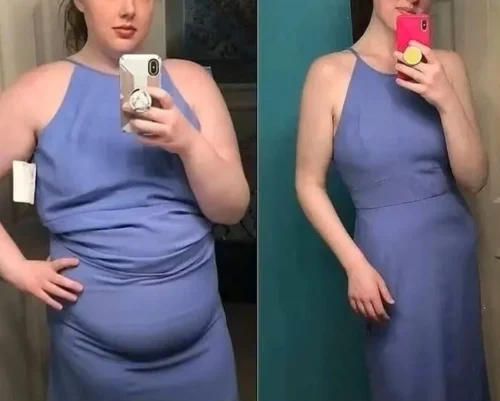 Australische Abnehm-Pflaster photo review