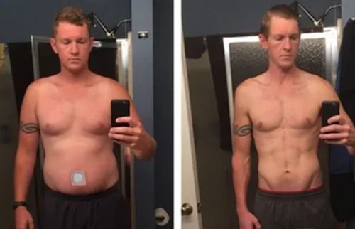 Australische Abnehm-Pflaster photo review