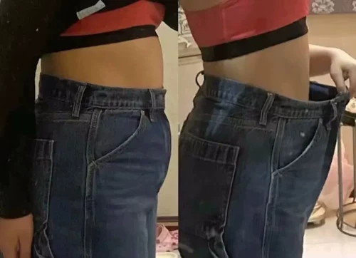 Australische Abnehm-Pflaster photo review